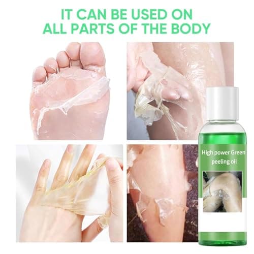Peeling Oil for Dark Skin Green Peeling Oil Solution Extra Strength Exfoliate Body Extra Strong Exfoliating Peels for Hand Feet Dark Knuckle Knee Elbow Chemical Peel Body for All Skin Type 3.38 FLOZ