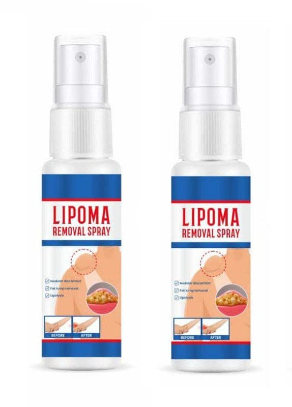 New Lipoma Removal Spray Mild Easy To Use Care Cream Wide Applications | Mild & Comfortable | Herbal Remedies & Resins, 30ml - (Pack of 2)