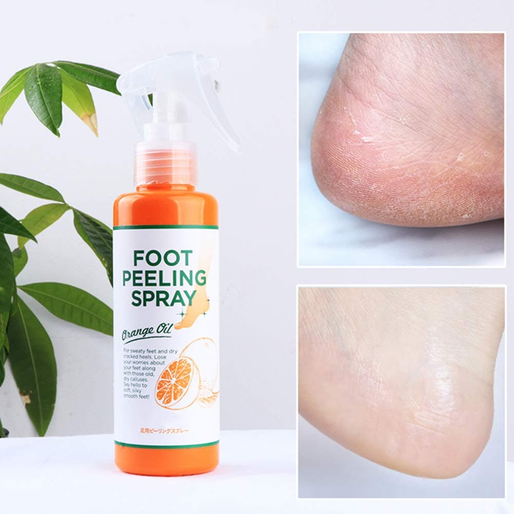 1PCS Foot Peeling Spray Orange Oil, Foot Peeling Spray Natural Orange Essence Pedicure Dead Skin Exfoliator for Cracked Rough Heels, Dry Toe Skin & Calluses A