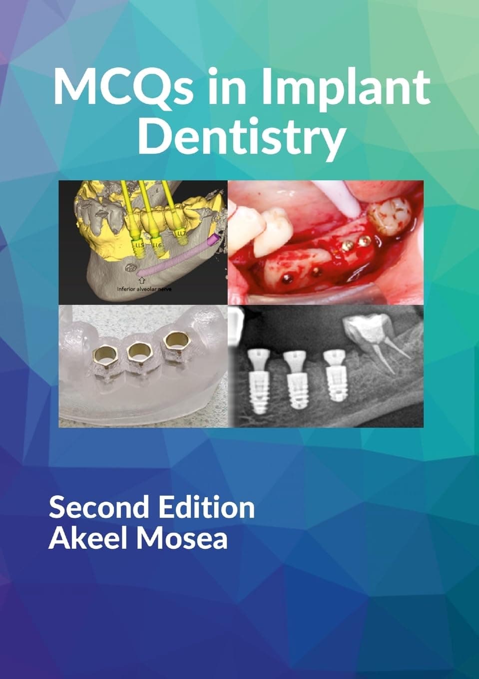 MCQS in Implant Dentistry