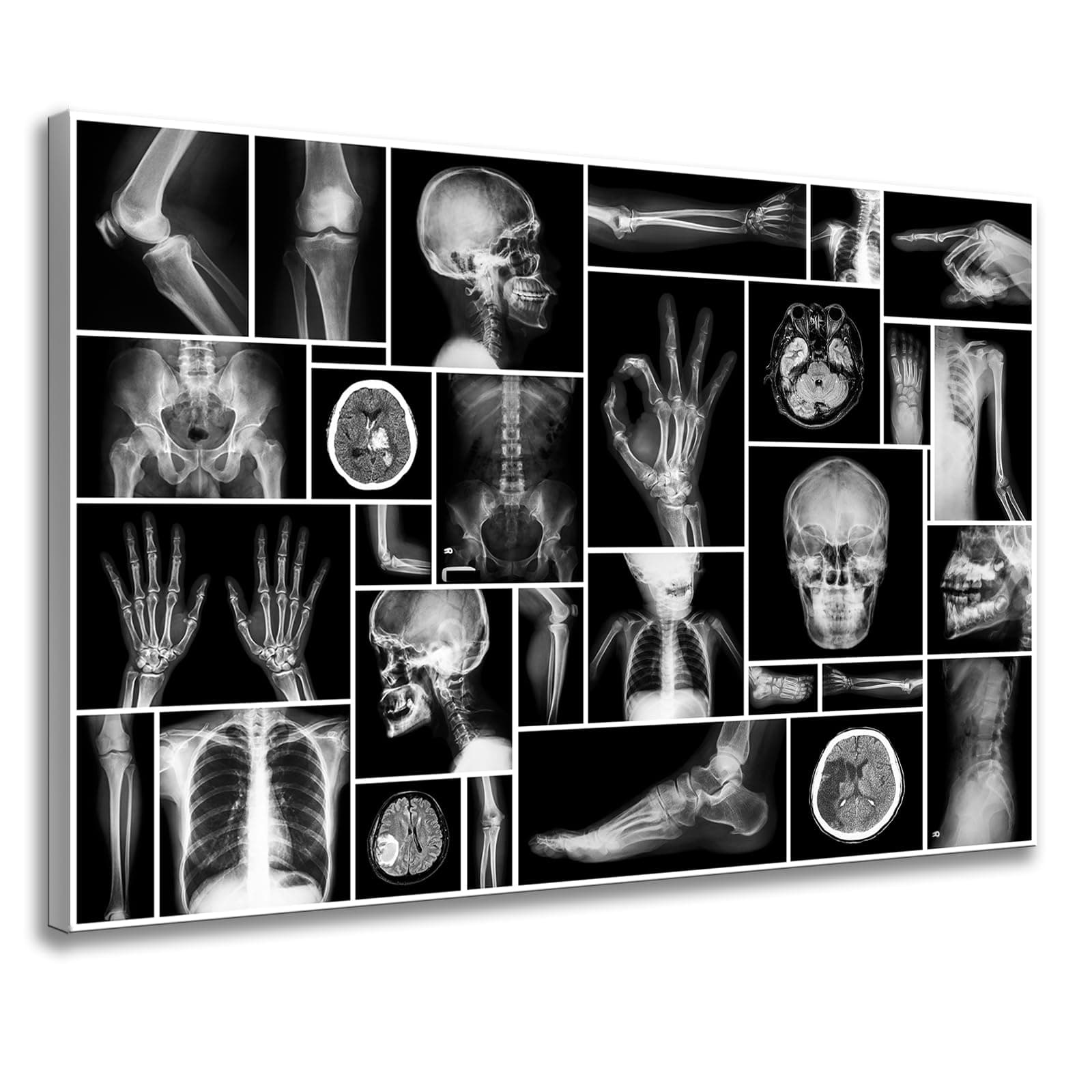 Black and White Human Skull Wall Art Canvas Painting X-Ray Picture Poster Prints Wall Picture For Hospital Orthopedic Surgeon Office Wall Decor Ready Hanging on 24x36inch (24"x36", Black and White)