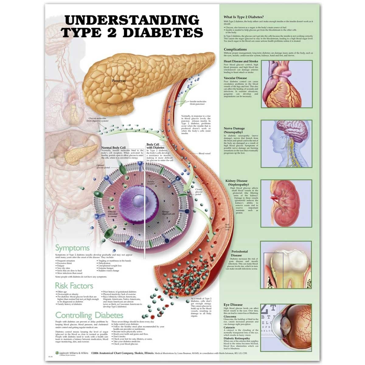 Understanding Type 2 Diabetes Anatomical Chart