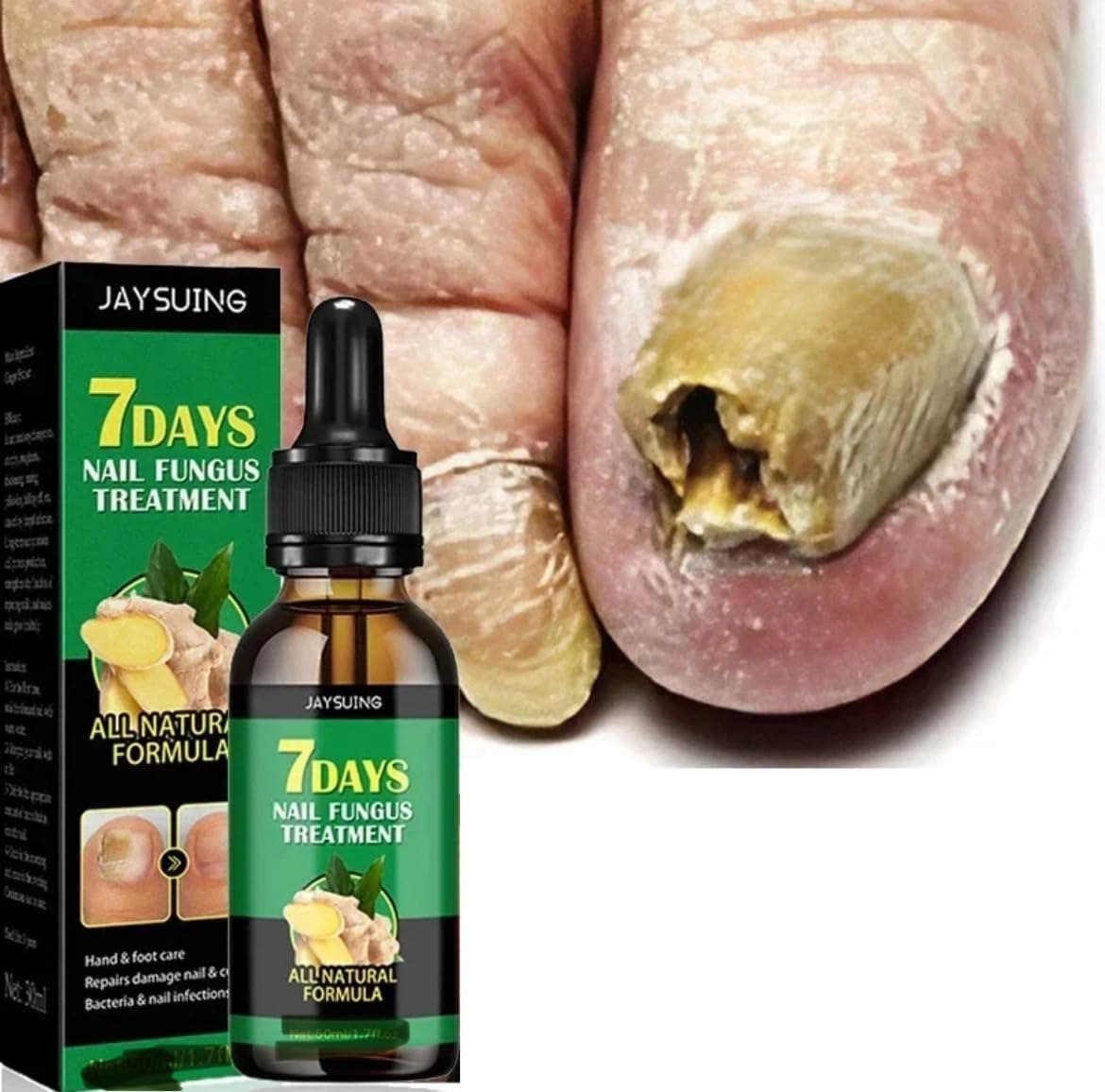 7 Days Nail Fungal Treatment Essence Oil Foot Toe Nail Fungus Removal Serum Repair Onychomycosi Anti Infection Gel Care Products